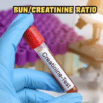 BUN/Creatinine Ratio
