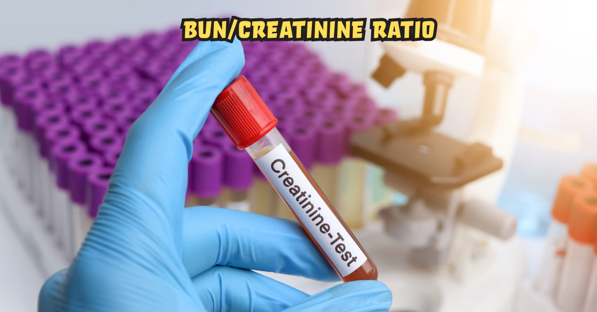 BUN/Creatinine Ratio