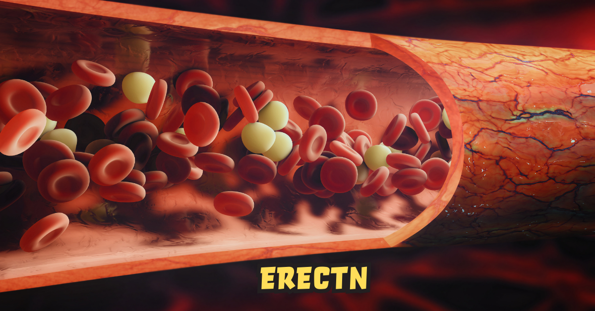 Erectn