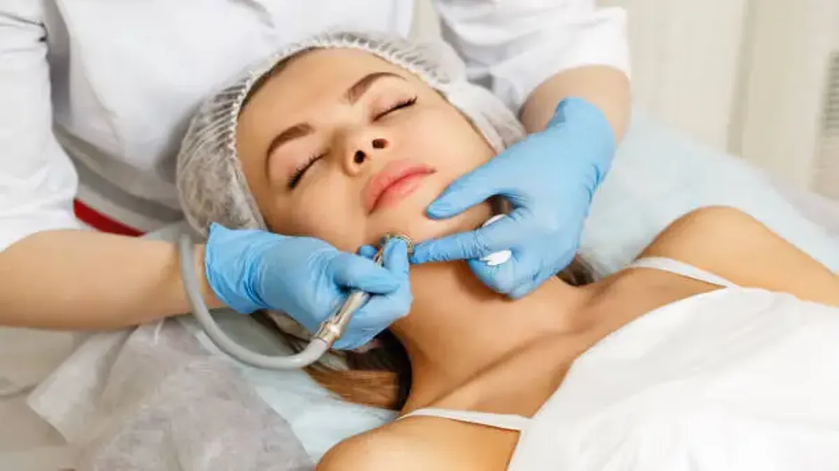 Microdermabrasion